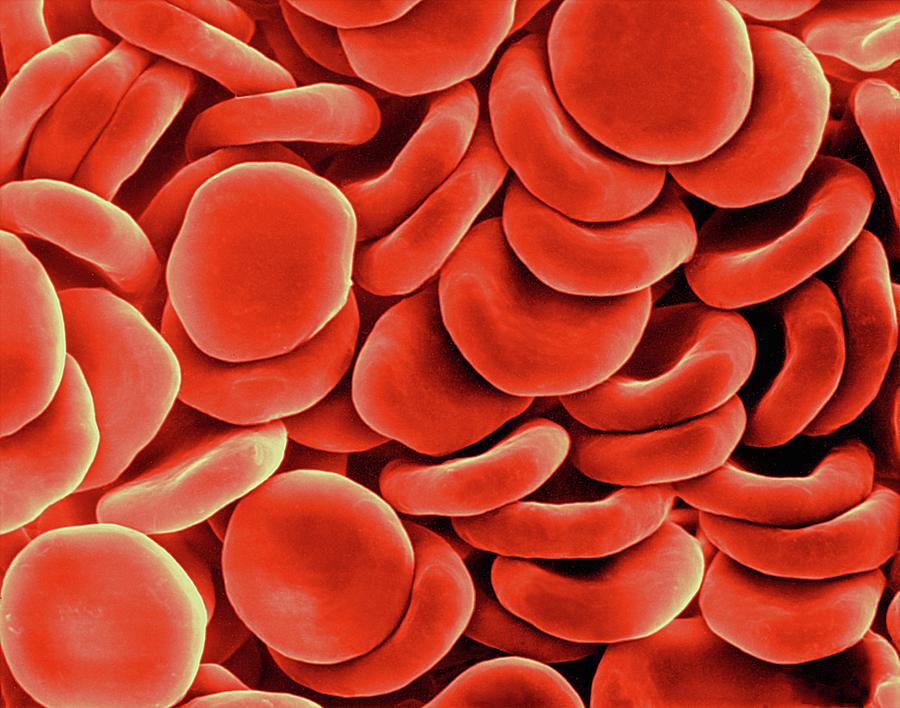 red-blood-cells-photograph-by-dennis-kunkel-microscopy-science-photo