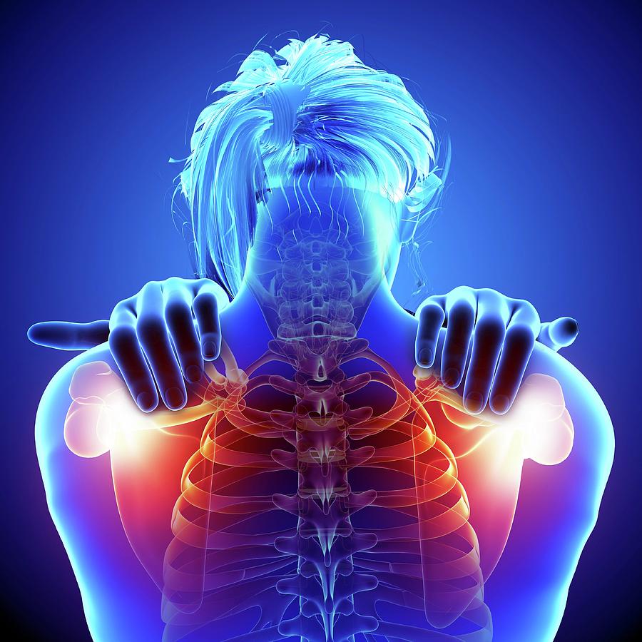 Shoulder Pain Photograph by Pixologicstudio/science Photo Library ...