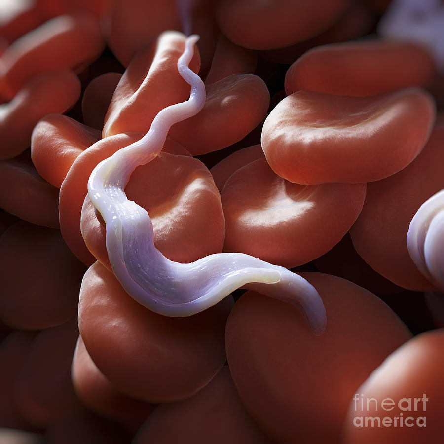 Infection Photograph - Sleeping Sickness Infection #14 by Science Picture Co