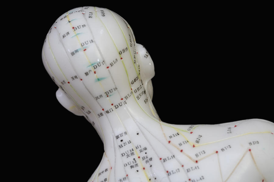 Acupuncture Points #15 Photograph by Science Stock Photography