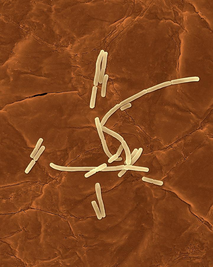 Bacillus Anthracis Photograph By Dennis Kunkel Microscopy Science Photo