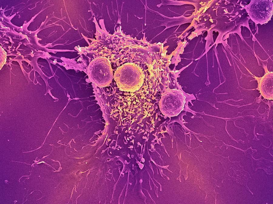 Cancer Cell And T Lymphocytes #15 Photograph by Steve Gschmeissner