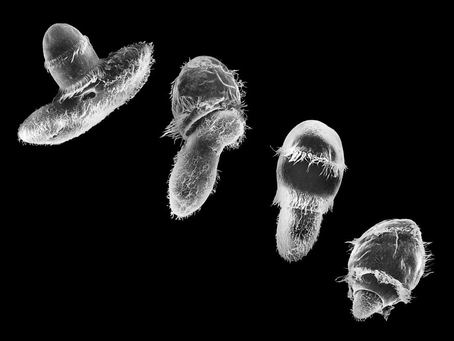 Didinium Ingesting Paramecium #15 Photograph by Greg Antipa