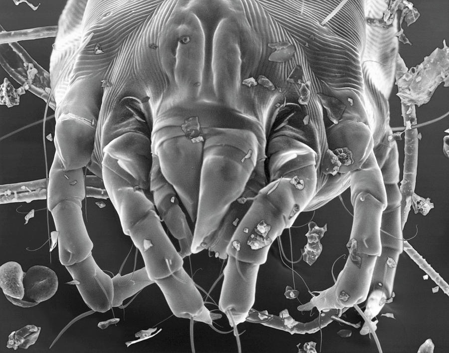 Dust Mite #15 Photograph by Dennis Kunkel Microscopy/science Photo Library