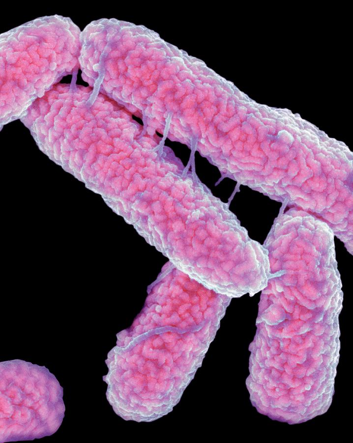 Escherichia Coli Photograph - E. Coli Bacteria #15 by Science Photo Library