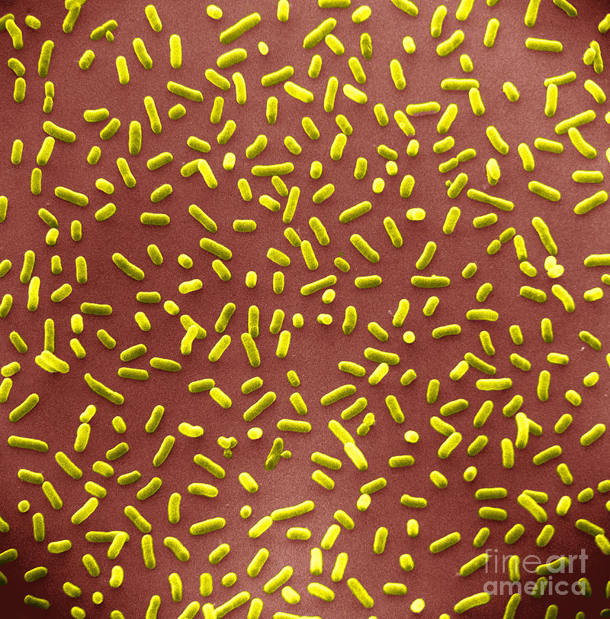 Escherichia Coli Photograph - E. Coli Bacteria Sem #15 by David M. Phillips