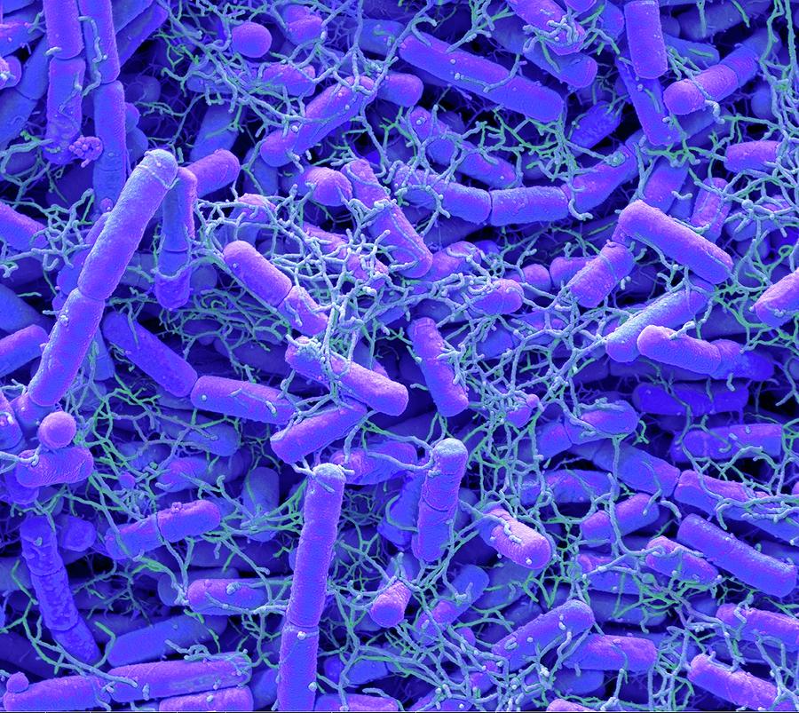 Microbiome #15 Photograph by Steve Gschmeissner/science Photo Library