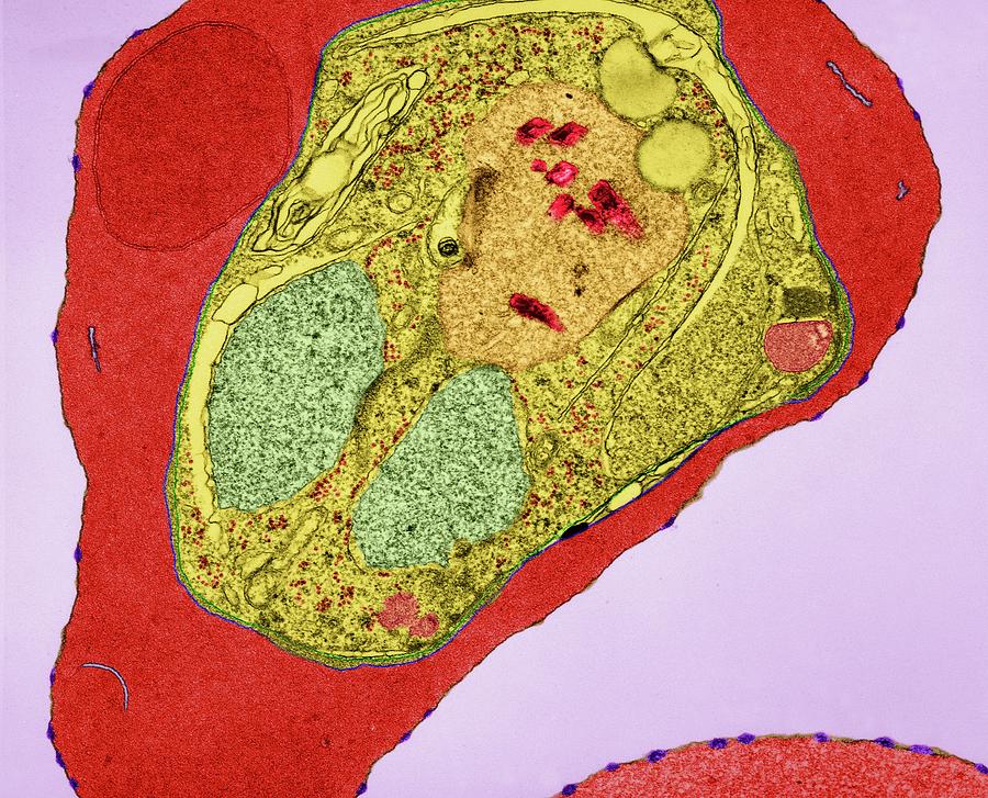 Plasmodium Falciparum #15 Photograph by Dennis Kunkel Microscopy/science Photo Library