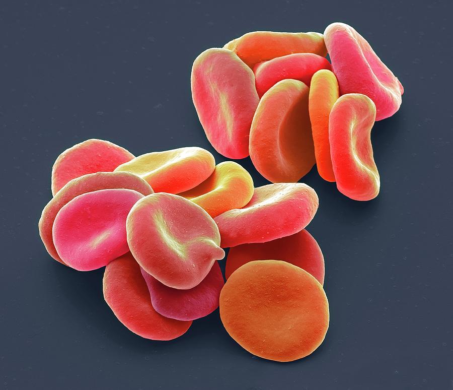 Red Blood Cells #15 Photograph by Steve Gschmeissner