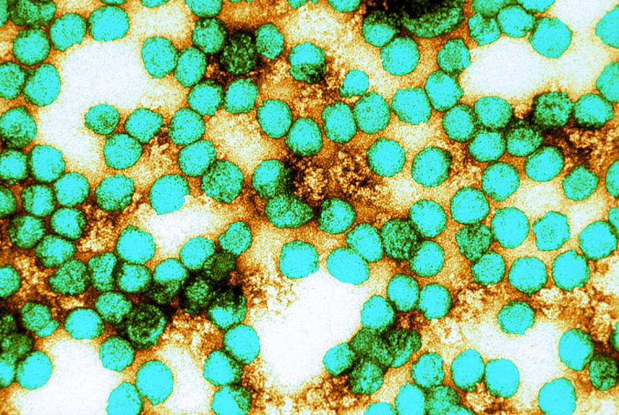 Yellow Fever Virus, Tem #15 Photograph by Science Source