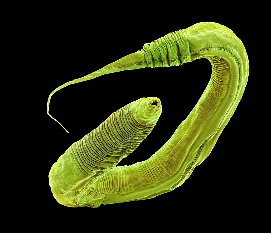 C. Elegans Worm #16 Photograph by Steve Gschmeissner
