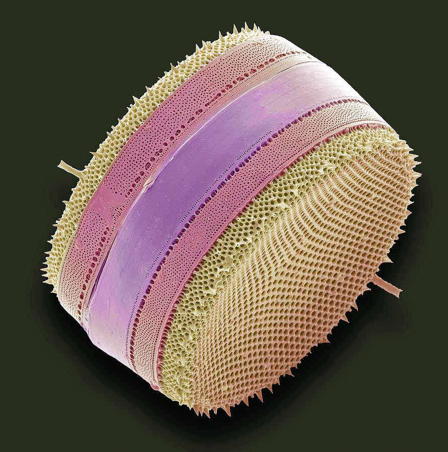 Nature Photograph - Diatom #16 by Steve Gschmeissner/science Photo Library