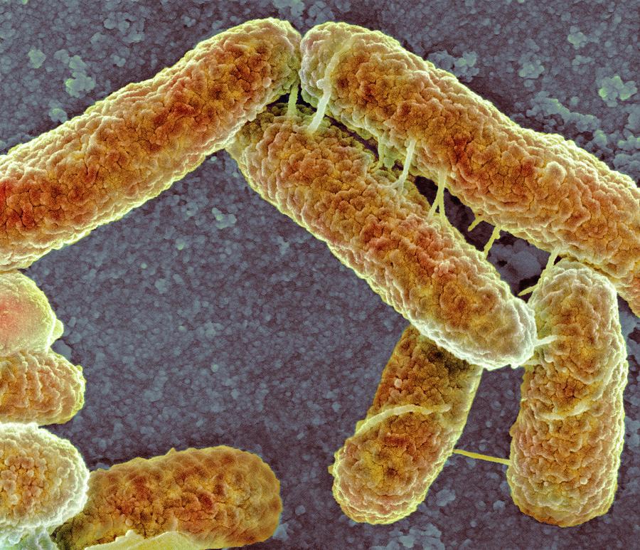 Escherichia Coli Photograph - E Coli Bacteria #16 by Science Photo Library