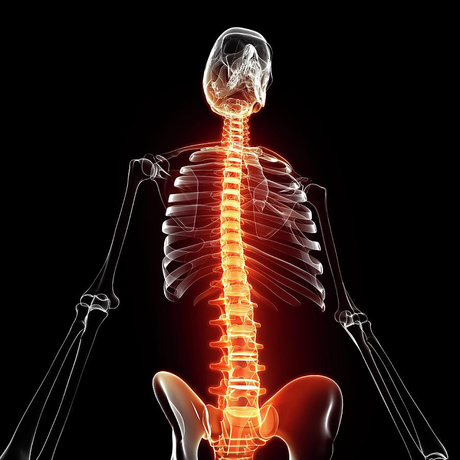 Joint Pain #16 Photograph by Pixologicstudio/science Photo Library