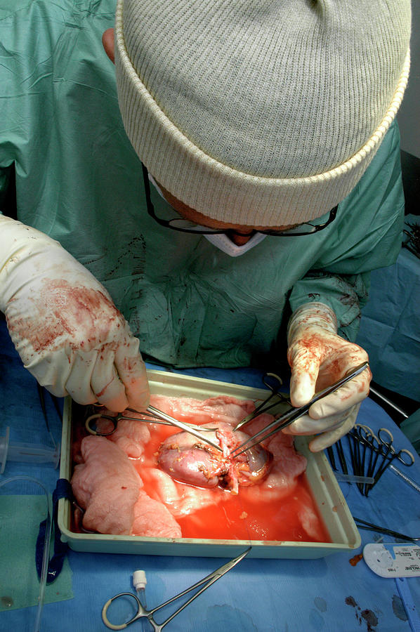 Kidney Transplant #16 Photograph by Aj Photo/science Photo Library