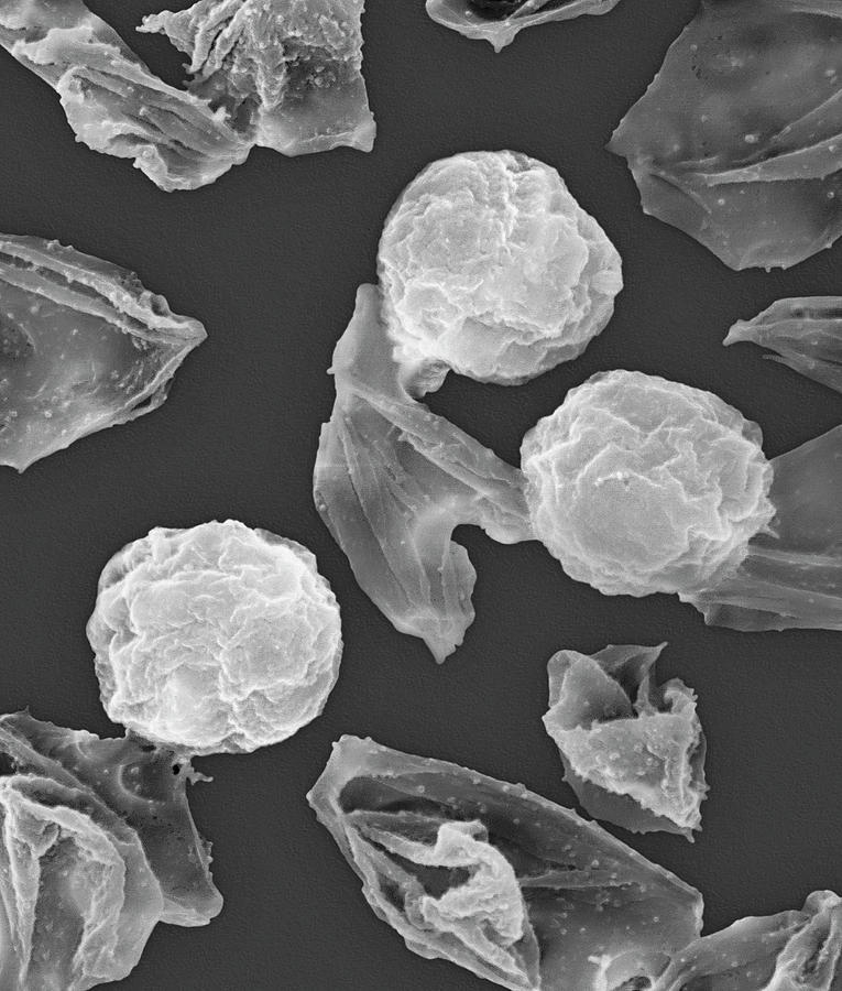 Plasmodium Falciparum #16 Photograph by Dennis Kunkel Microscopy/science Photo Library