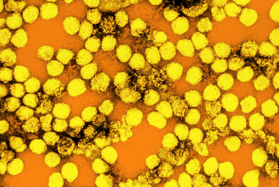 Yellow Fever Virus, Tem #16 Photograph by Science Source