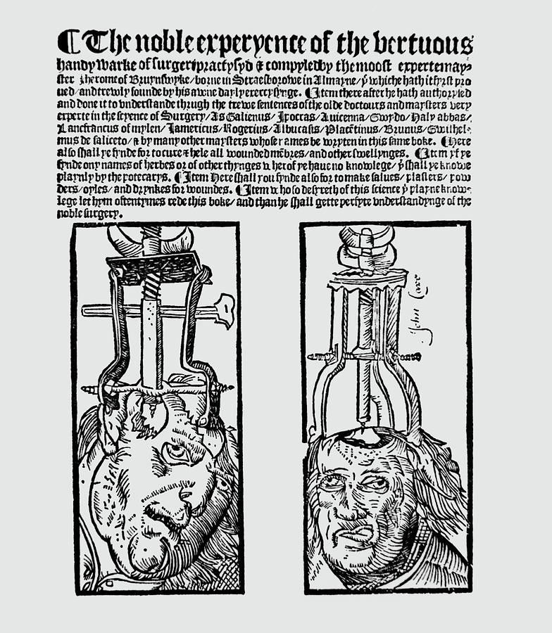 16th Century Surgery Book By Jerome Of Brunswick Photograph by Science Photo Library