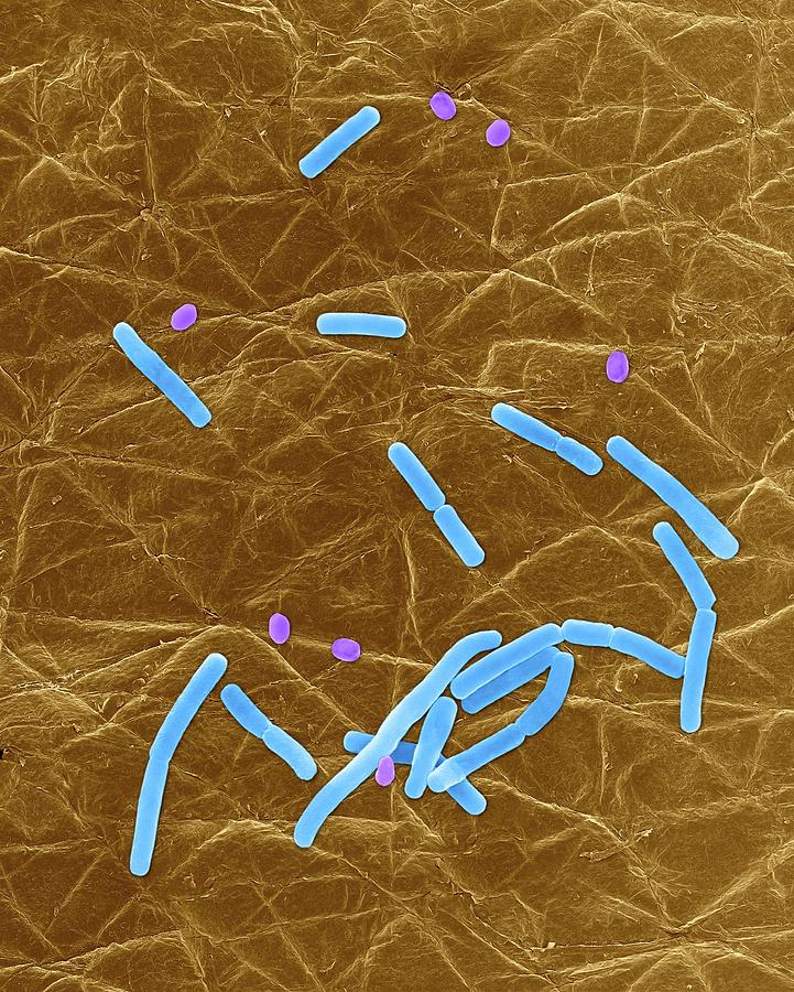 Bacillus Anthracis Morphology