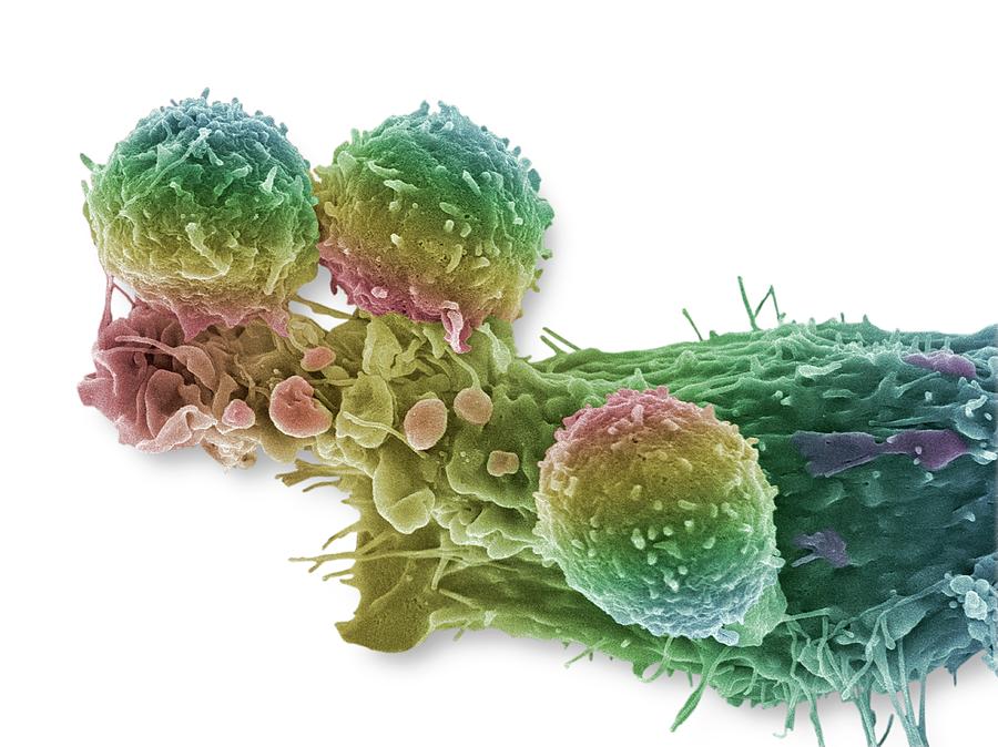Cancer Cell And T Lymphocytes #17 Photograph by Steve Gschmeissner