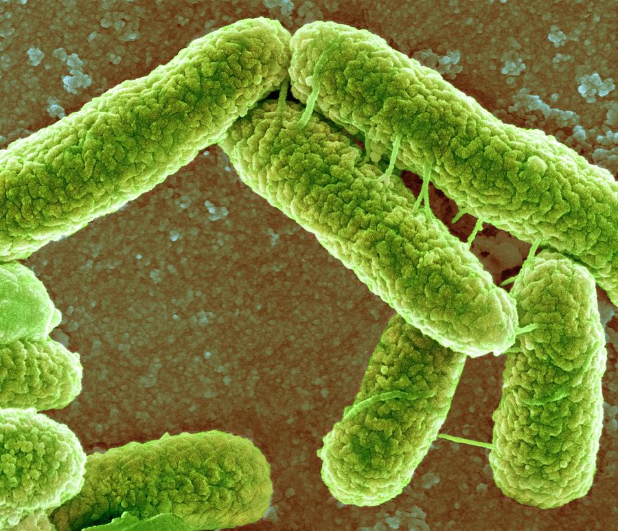 Escherichia Coli Photograph - E Coli Bacteria #17 by Science Photo Library