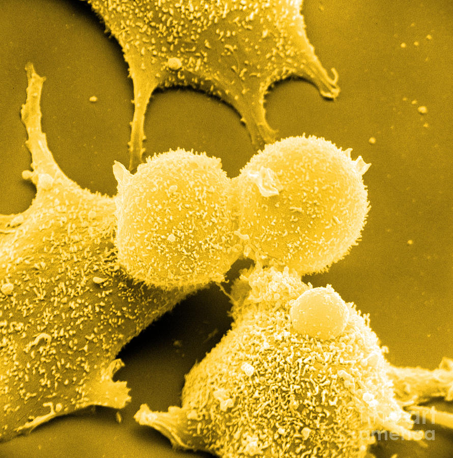 kid3 cardiomyocyte kid3 cardiomyocyte