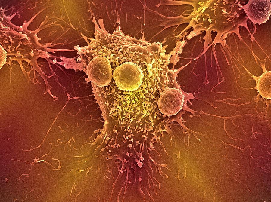 Antigen Photograph - Cancer Cell And T Lymphocytes #18 by Steve Gschmeissner