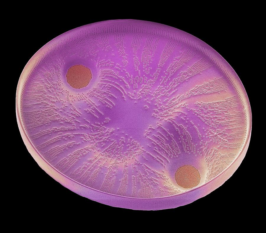 Nature Photograph - Diatom #18 by Steve Gschmeissner