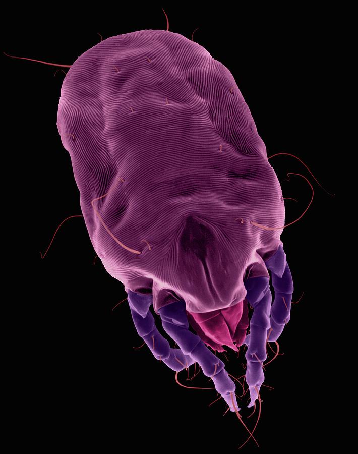 Dust Mite #18 Photograph by Dennis Kunkel Microscopy/science Photo Library