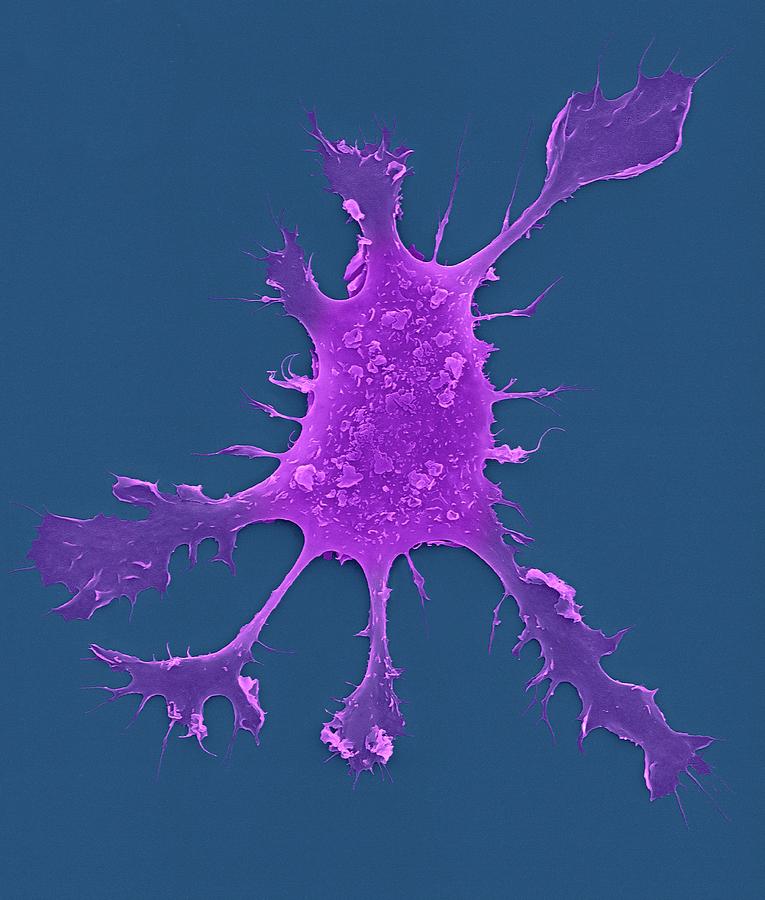Human Dendritic Cell Photograph By Dennis Kunkel Microscopyscience