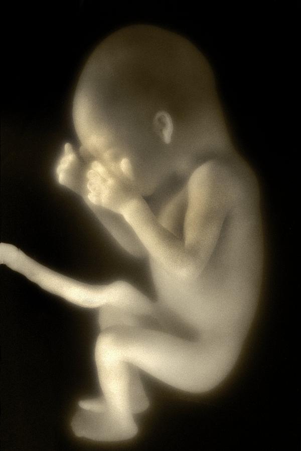 Human foetus in the womb Photograph by Science Photo Library - Pixels