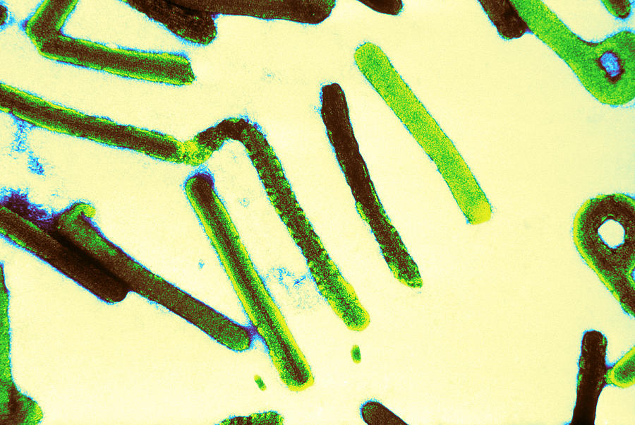 Marburg Virus, Tem #18 Photograph by Science Source