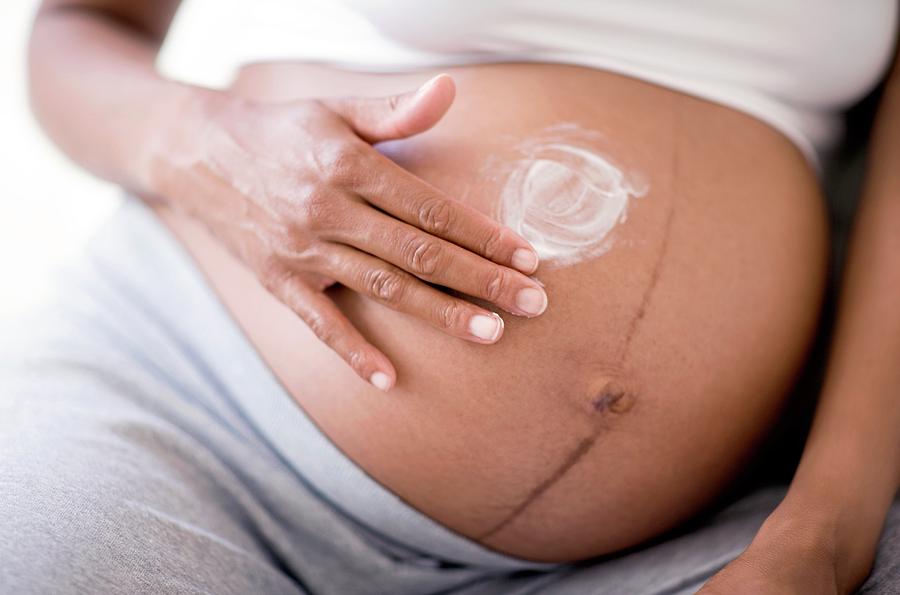 Pregnant Woman #184 Photograph by Ian Hooton/science Photo Library