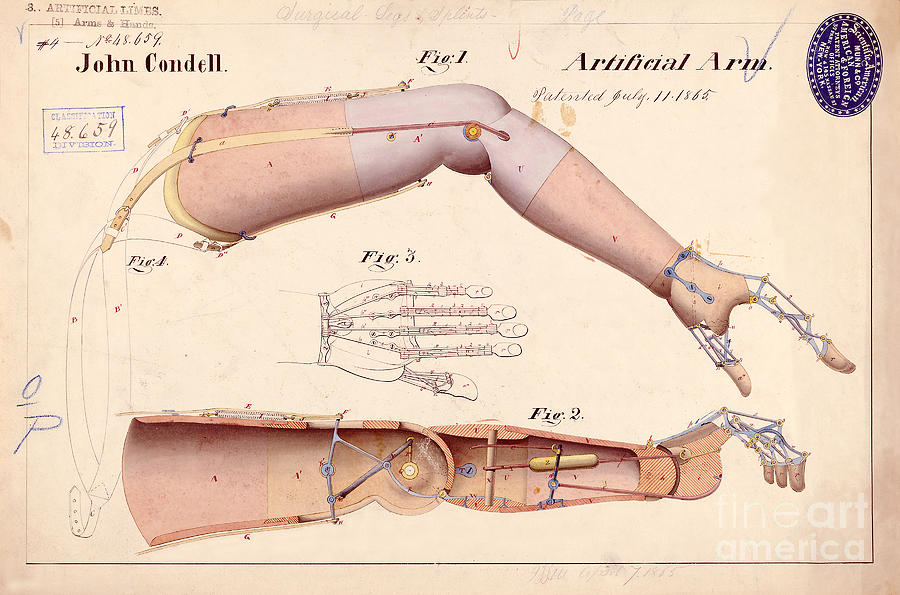 1865 Artificial Limbs Patent Drawing Drawing by Jon Neidert