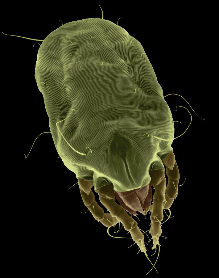 microscopic dust mites