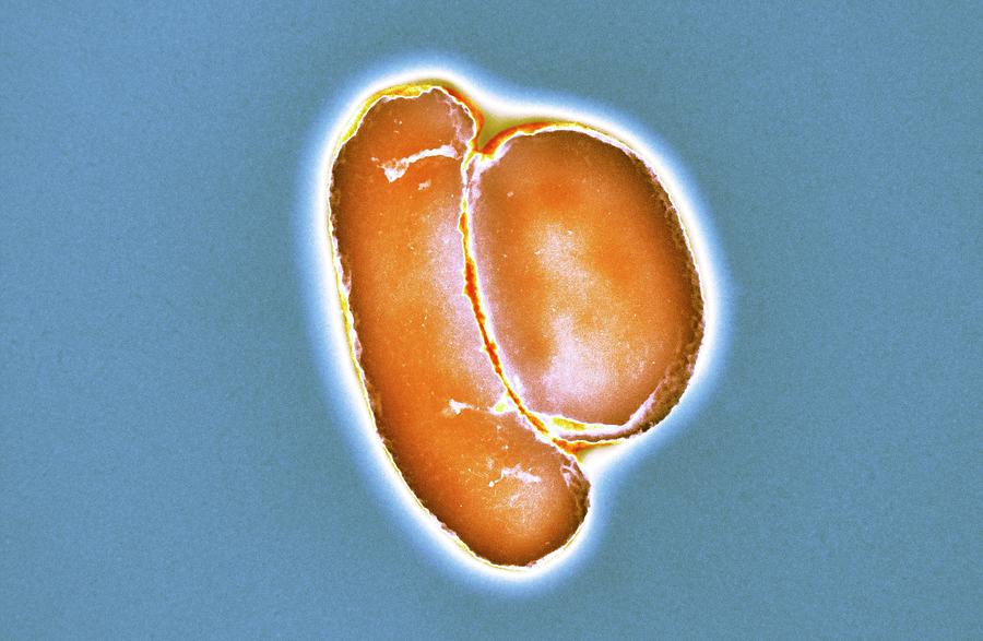 Escherichia Coli Photograph - E. Coli Bacteria #19 by Centre For Infections/public Health England/science Photo Library