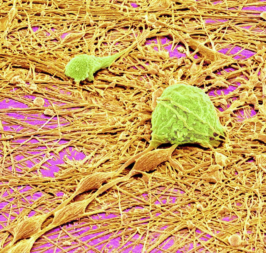 Nervous System Cells #19 Photograph by Susumu Nishinaga