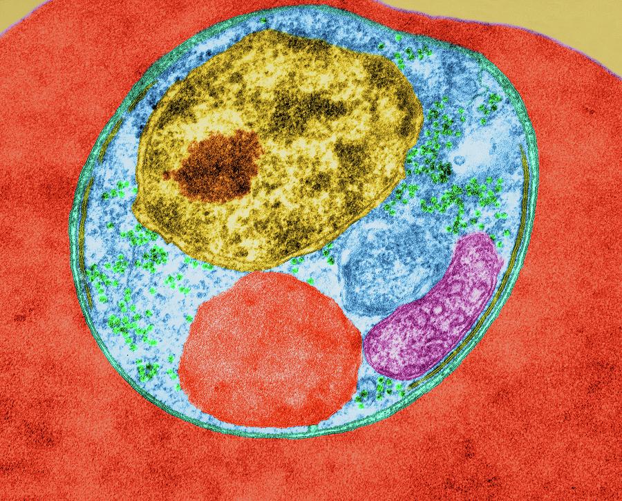 Plasmodium Falciparum Photograph by Dennis Kunkel Microscopy/science ...