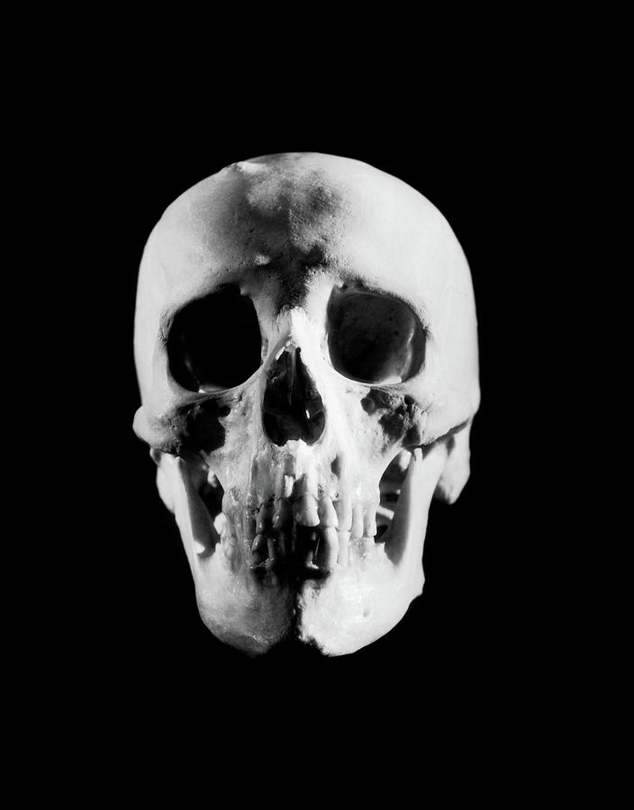1930s Portrait Human Skull Looking Photograph By Vintage Images