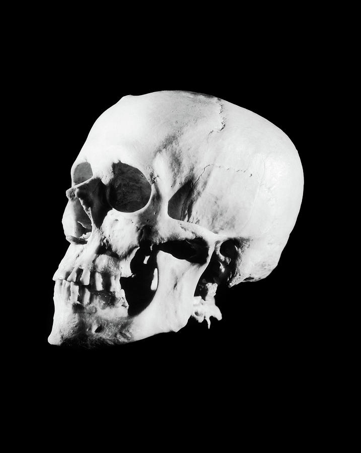 1930s Profile Of Human Skull White Bone Photograph By Vintage Images