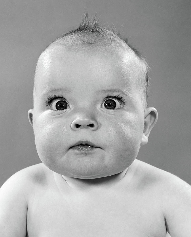 1950s Close-up Of Baby With Bulging Photograph by Vintage Images - Fine ...