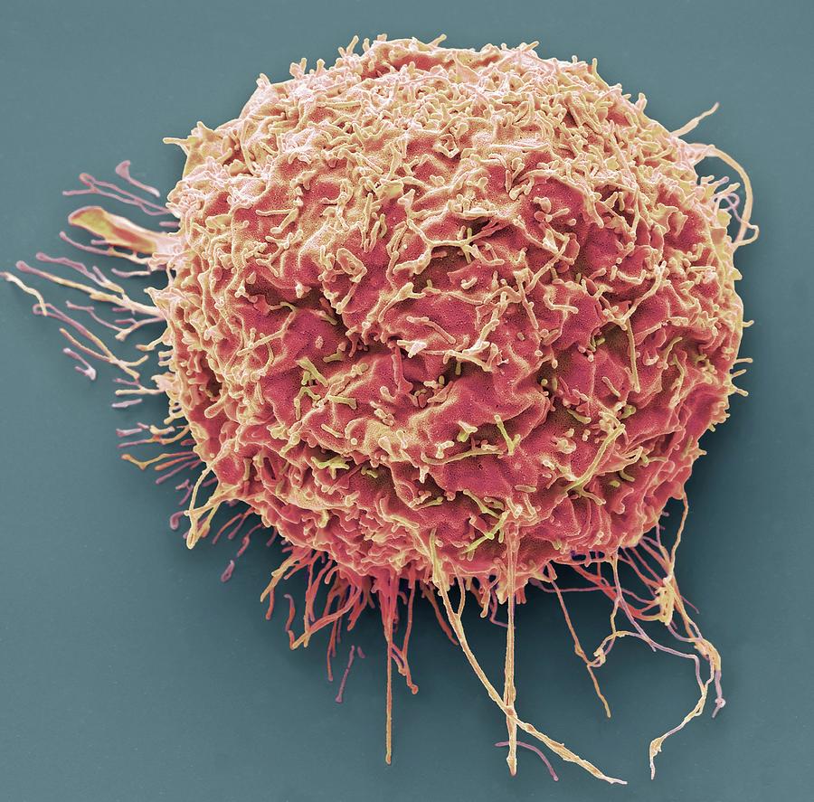 293t Cells In Culture Photograph by Steve Gschmeissner/science Photo ...