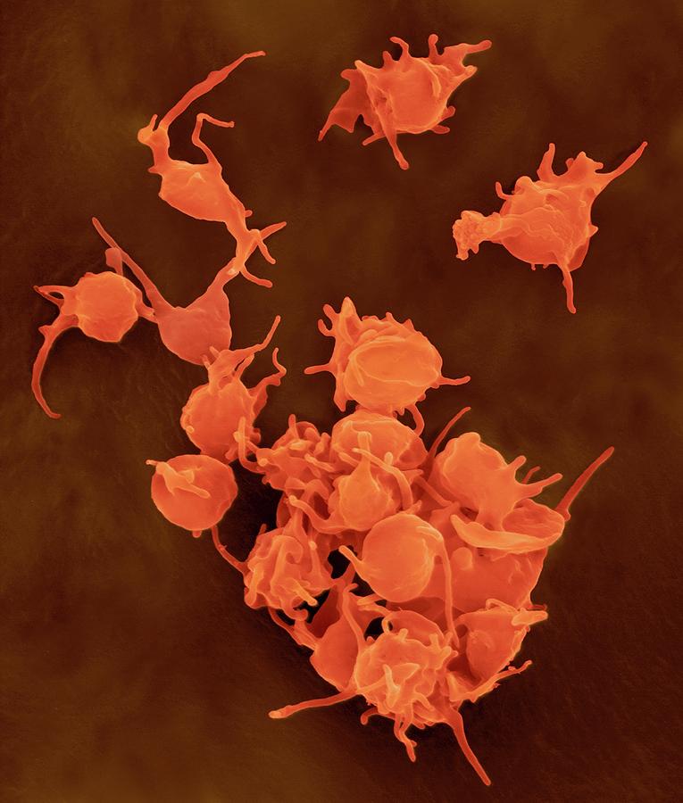 Activated Platelets Photograph By Dennis Kunkel Microscopyscience Photo Library