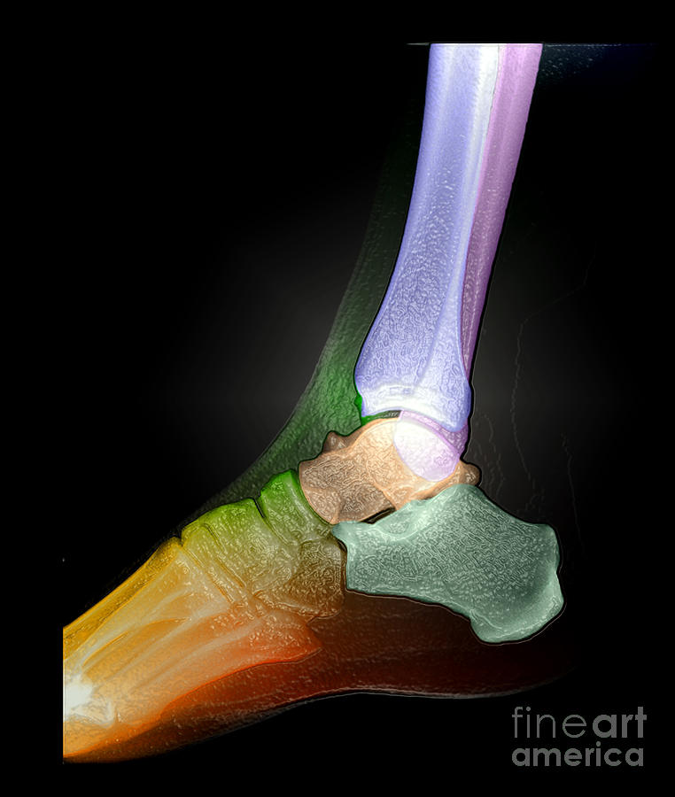 Ankle X-ray, Normal #2 Photograph by Living Art Enterprises