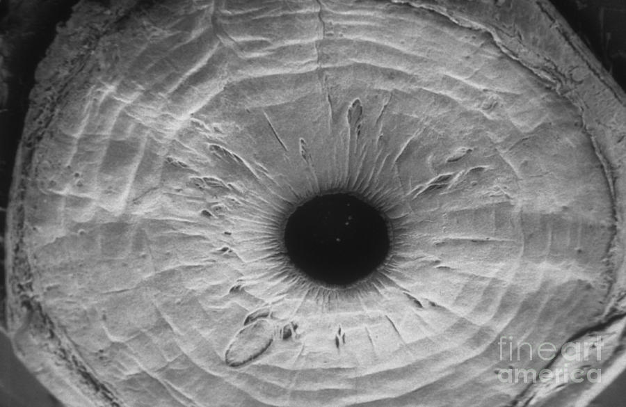 Anterior Surface Of Iris, Sem #2 Photograph by Ralph C. Eagle, Jr.