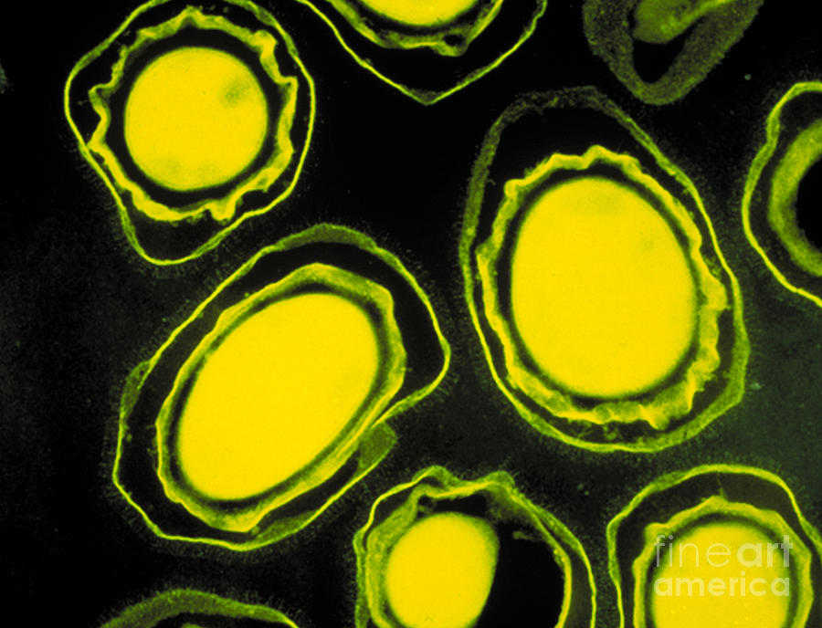 Anthrax Spores #2 Photograph by Scott Camazine