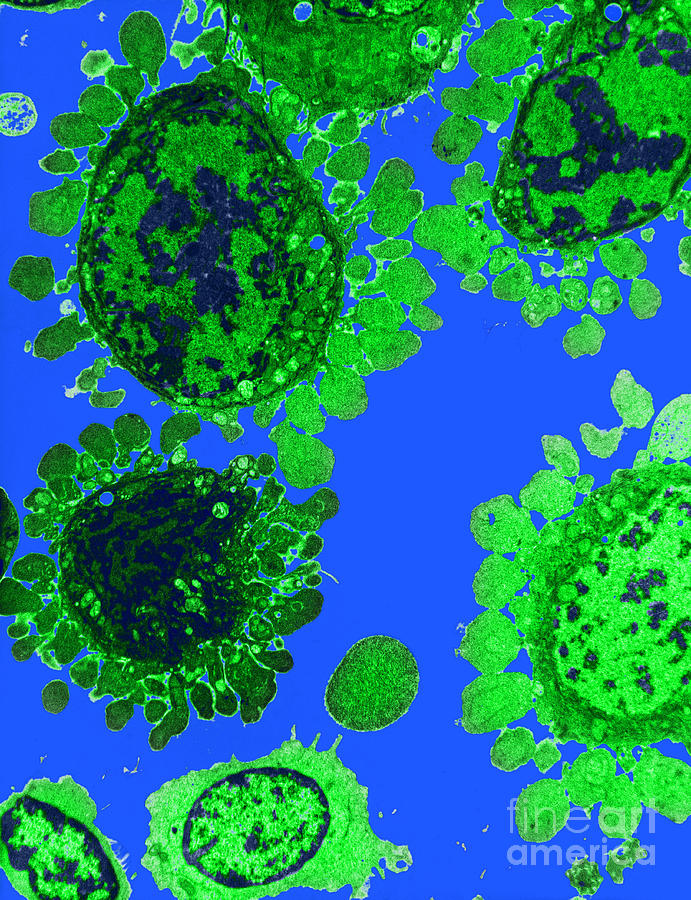 kid3 cardiomyocyte kid3 cardiomyocyte