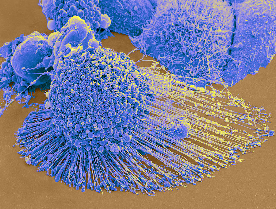 Apoptotic Hela Cell, Sem #2 Photograph by Science Source