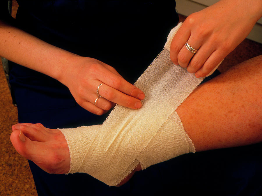 Applying Bandage To Sprained Ankle Photograph by Hattie Young/science