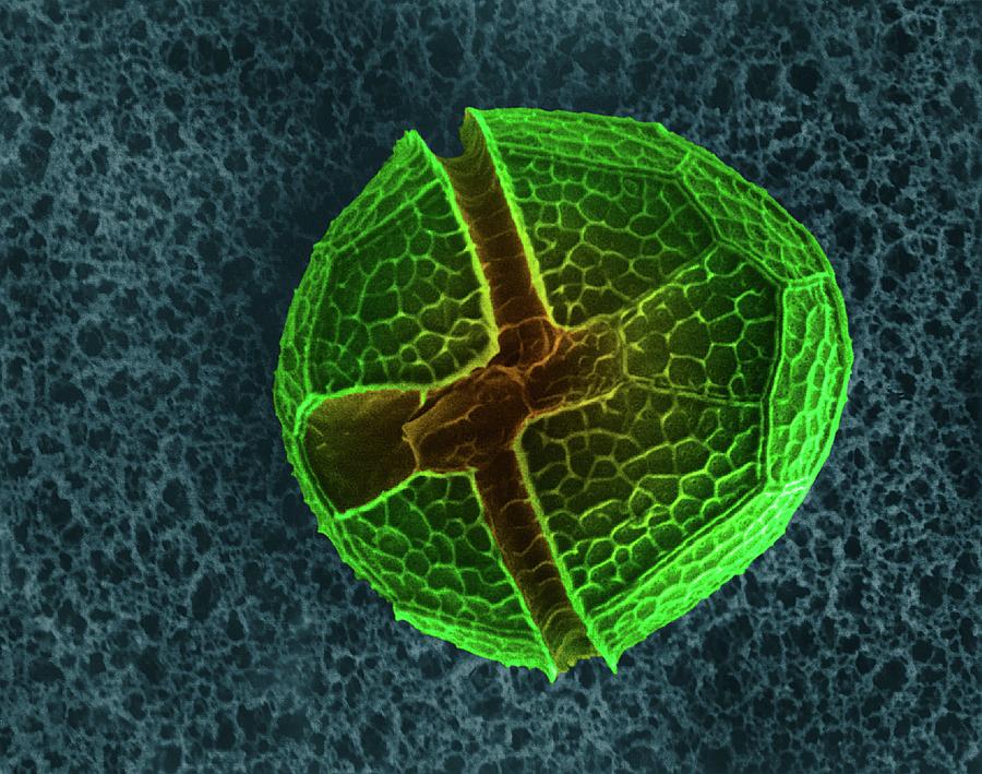 Armoured Dinoflagellate (peridinium Sp.) #2 Photograph by Dennis Kunkel Microscopy/science Photo Library